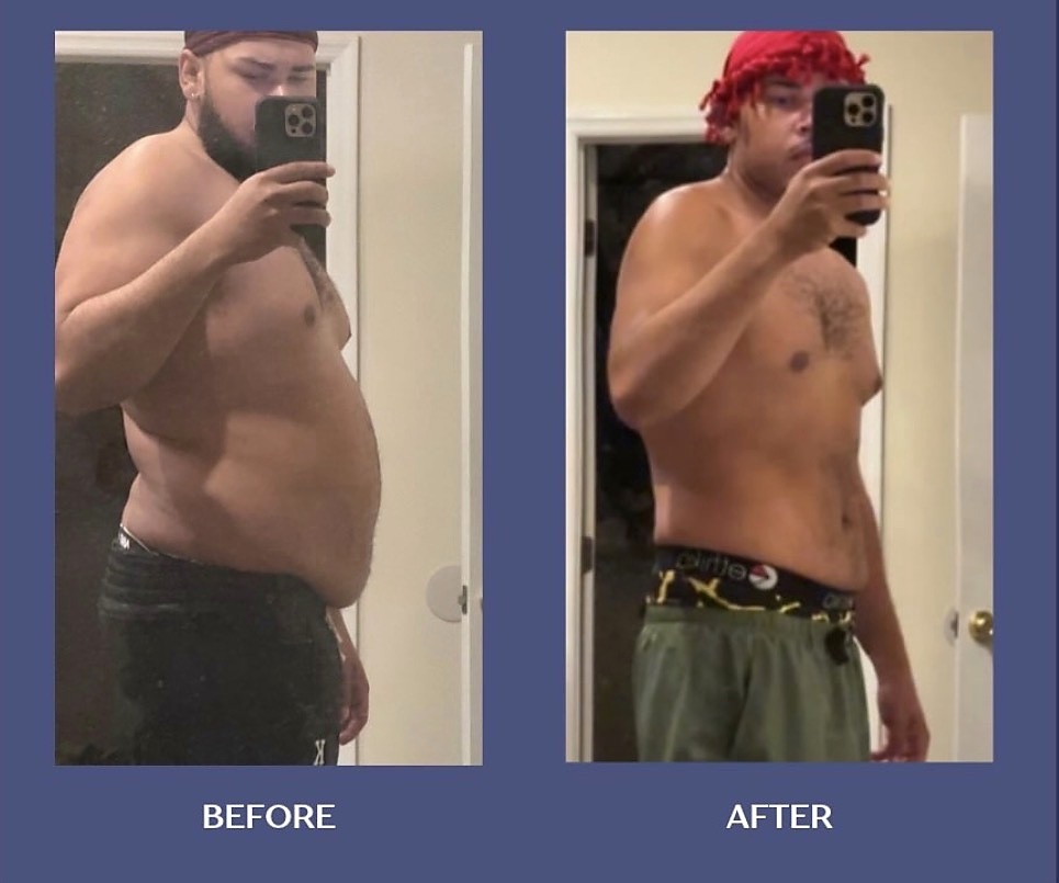 Supplied before-and-after comparison, example two