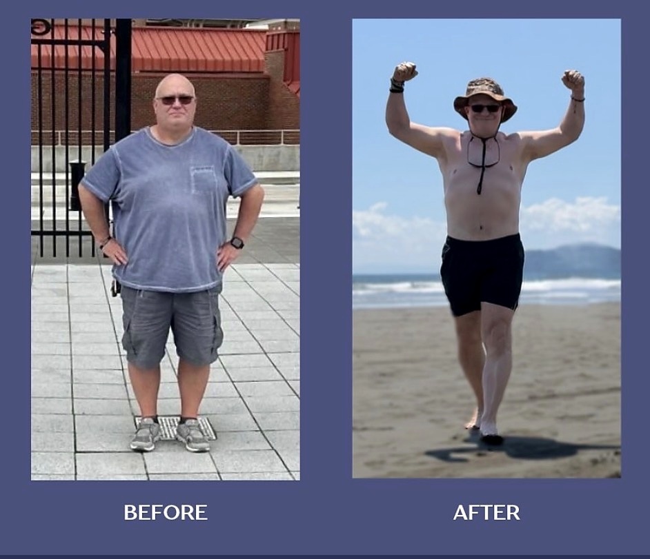 Supplied before-and-after comparison, example three